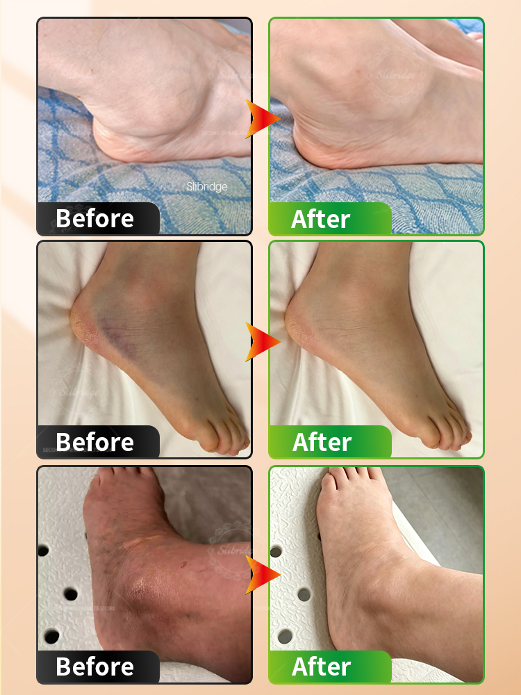 Taşınabilir Isıtmalı Ayak Bile - Ankle Mobility Band incelemesi ve fiyatı